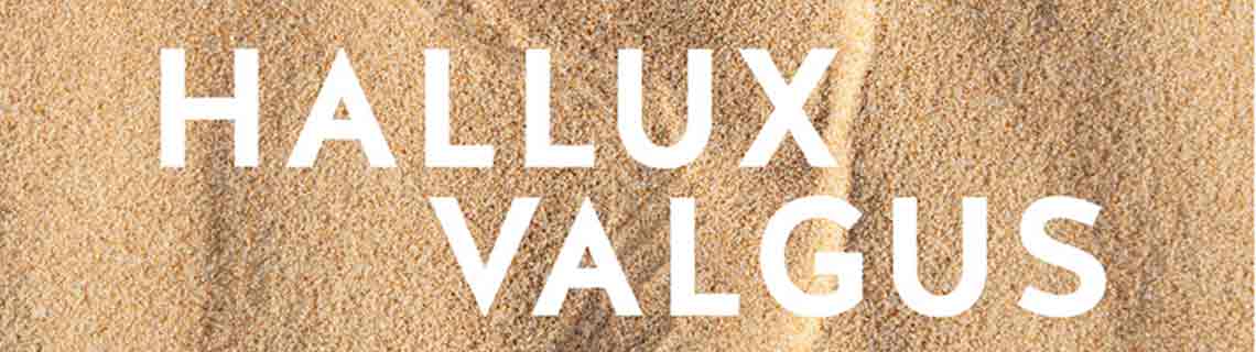 Hallux valgus